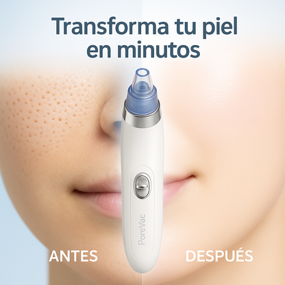 Limpiador Facial por Succión – PoreVac